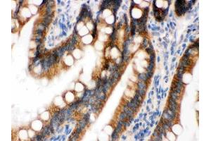 IHC analysis of RENT1/hUPF1 using anti-RENT1/hUPF1 antibody (ABIN3043955).