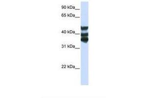 Image no. 1 for anti-Homogentisate 1,2-Dioxygenase (HGD) (AA 252-301) antibody (ABIN6738765) (HGD anticorps  (AA 252-301))