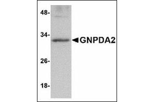 Western blot analysis of GNPDA2 in human kidney lysate with GNPDA2 antibody at 1 µg/ml. (GNPDA2 anticorps  (C-Term))