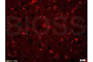 Formalin-fixed and paraffin embedded rat brain labeled with Rabbit Anti BNP Polyclonal Antibody, Unconjugated (ABIN678623) at 1:200 followed by conjugation to the secondary antibody and DAB staining (BNP anticorps  (AA 85-115))