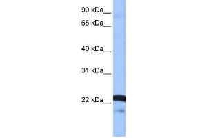 WB Suggested Anti-SFRS9 Antibody Titration: 0. (SFRS9 anticorps  (Middle Region))