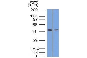 Western Blot Analysis (A) MCF-7 (B) PC3 cell lysate Using FOXA1 Monoclonal Antibody (FOXA1/1512) (FOXA1 anticorps  (AA 372-472))