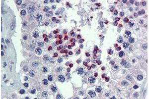 Human Testis: Formalin-Fixed, Paraffin-Embedded (FFPE)