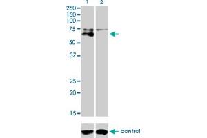 Western blot analysis of ALPL over-expressed 293 cell line, cotransfected with ALPL Validated Chimera RNAi (Lane 2) or non-transfected control (Lane 1). (ALPL anticorps  (AA 91-200))