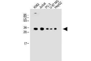 All lanes : Anti-P1R3G Antibody (C-term) at 1:1000 dilution Lane 1: K562 whole cell lysate Lane 2: Jurkat whole cell lysate Lane 3: PC-3 whole cell lysate Lane 4: U-87 MG whole cell lysate Lane 5: HepG2 whole cell lysate Lysates/proteins at 20 μg per lane. (PPP1R3G anticorps  (C-Term))