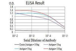 Black line: Control Antigen (100 ng),Purple line: Antigen (10 ng), Blue line: Antigen (50 ng), Red line:Antigen (100 ng)