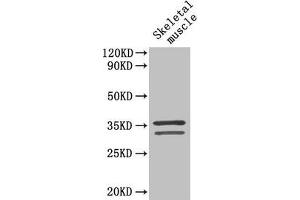 Western Blot Positive WB detected in: Mouse skeletal muscle tissue All lanes: TNNT2 antibody at 4 μg/mL Secondary Goat polyclonal to rabbit IgG at 1/50000 dilution Predicted band size: 36, 35, 32, 31 kDa Observed band size: 36, 32 kDa