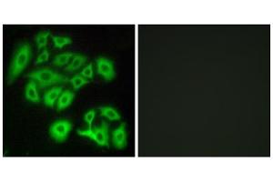 Immunofluorescence analysis of A549 cells, using FZD4 antibody. (FZD4 anticorps  (Internal Region))