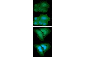 ICC/IF analysis of PARK7 in Hep3B cells line, stained with DAPI (Blue) for nucleus staining and monoclonal anti-human PARK7 antibody (1:100) with goat anti-mouse IgG-Alexa fluor 488 conjugate (Green).