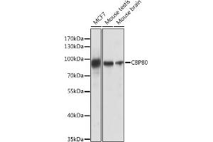 Western blot analysis of extracts of various cell lines, using CBP80 antibody (ABIN6134006, ABIN6138009, ABIN6138010 and ABIN6218117) at 1:1000 dilution. (NCBP1 anticorps)
