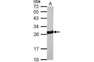 WB Image Sample (50 ug of whole cell lysate) A: mouse heart 12% SDS PAGE antibody diluted at 1:10000 (MYL3/CMLC1 anticorps)