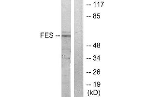 Western Blotting (WB) image for anti-Feline Sarcoma Oncogene (FES) (Internal Region) antibody (ABIN1849116) (FES anticorps  (Internal Region))