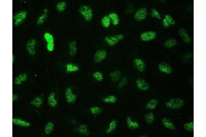 IF analysis of CTBP2 using anti-CTBP2 antibody (ABIN3042768). (CTBP2 anticorps  (AA 321-445))