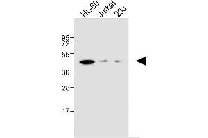 All lanes : Anti-EDG6 Antibody at 1:1000 dilution Lane 1: HL-60 whole cell lysate Lane 2: Jurkat whole cell lysate Lane 3: 293 whole cell lysate Lysates/proteins at 20 μg per lane. (S1PR4 anticorps  (N-Term))