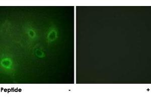 Immunofluorescence analysis of COS-7 cells, using ITPR1 polyclonal antibody .