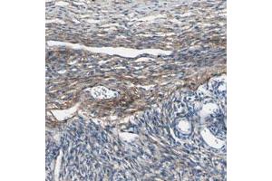 Immunohistochemical staining (Formalin-fixed paraffin-embedded sections) of human ovary with COL6A3 polyclonal antibody  shows moderate cytoplasmic positivity in ovarian stromal cells. (COL6a3 anticorps)