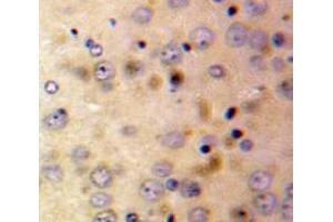 Used in DAB staining on fromalin fixed paraffin-embedded Brain tissue