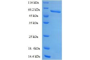 SDS-PAGE (SDS) image for Plasminogen Activator, Urokinase Receptor (PLAUR) (AA 23-305) protein (GST tag) (ABIN5710113) (PLAUR Protein (AA 23-305) (GST tag))