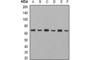 Western blot analysis of CCT3 expression in MCF7 (A), THP1 (B), mouse ovary (C), mouse thymus (D), rat spleen (E), rat heart (F) whole cell lysates. (CCT3 anticorps)