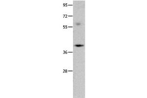 Western Blot analysis of Mouse brain tissue using OPCML Polyclonal Antibody at dilution of 1:400 (OPCML anticorps)