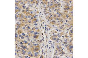 Immunohistochemistry (IHC) image for anti-VAMP (Vesicle-Associated Membrane Protein)-Associated Protein B and C (VAPB) antibody (ABIN1876551) (VAPB anticorps)