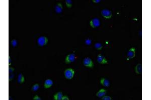 Immunofluorescent analysis of A549 cells using ABIN7169063 at dilution of 1:100 and Alexa Fluor 488-congugated AffiniPure Goat Anti-Rabbit IgG(H+L) (MAK anticorps  (AA 200-440))