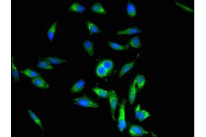 Immunofluorescent analysis of Hela cells using ABIN7162915 at dilution of 1:100 and Alexa Fluor 488-congugated AffiniPure Goat Anti-Rabbit IgG(H+L)