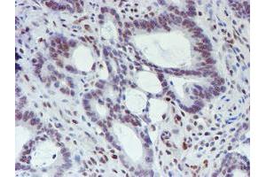 Image no. 5 for anti-WW Domain Containing Transcription Regulator 1 (WWTR1) antibody (ABIN1501763) (WWTR1 anticorps)