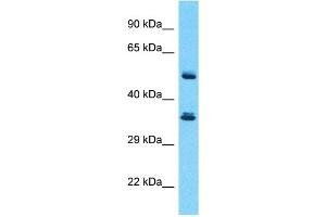 Host:  Rabbit  Target Name:  SERPINB3  Sample Type:  Thymus Tumor lysates  Antibody Dilution:  1.