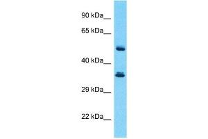 Host:  Rabbit  Target Name:  SERPINB3  Sample Type:  Thymus Tumor lysates  Antibody Dilution:  1. (SERPINB3 anticorps  (Middle Region))