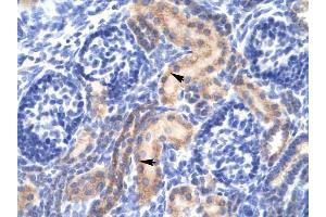 PCK1 antibody was used for immunohistochemistry at a concentration of 4-8 ug/ml to stain Epithelial cells of renal tubule (arrows) in Human Kidney. (PCK1 anticorps  (Soluble))