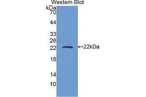 Western blot analysis of the recombinant protein. (FTH1 anticorps  (AA 1-171))