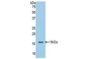 Western blot analysis of recombinant Rat CDHE.