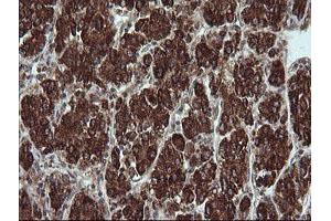 Image no. 7 for anti-Tripartite Motif Containing 44 (TRIM44) antibody (ABIN1501505) (TRIM44 anticorps)