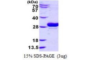 Image no. 1 for Ubiquitin-Conjugating Enzyme E2, J2 (UBE2J2) protein (His tag) (ABIN1098322)