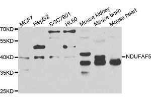 Western blot analysis of extracts of various cell lines, using NDUFAF5 antibody. (C20orf7 anticorps)