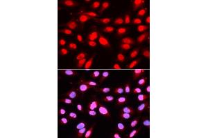 Immunofluorescence analysis of U2OS cells using U2AF2 antibody. (U2AF2 anticorps)