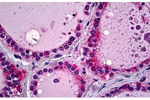 Human Thyroid: Formalin-Fixed, Paraffin-Embedded (FFPE) (SFTPD anticorps  (AA 21-376))