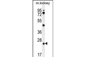 PGPEP1 Antibody (N-term) (ABIN655631 and ABIN2845110) western blot analysis in mouse kidney tissue lysates (35 μg/lane). (PGPEP1 anticorps  (N-Term))