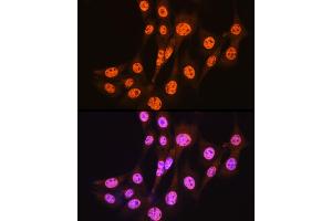 anti-SMAD, Mothers Against DPP Homolog 3 (SMAD3) antibody