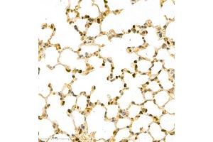 Immunohistochemistry of paraffin embedded mouse pneumonia using MNDA (ABIN7074709) at dilution of 1:2000 (400x lens) (MNDA anticorps)