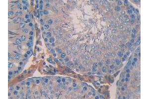 Used in DAB staining on fromalin fixed paraffin- embedded stomach tissue (ANGPTL2 anticorps  (AA 47-207))