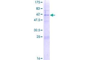 Image no. 1 for Ribosomal Protein S4, Y-Linked 1 (RPS4Y1) (AA 1-263) protein (GST tag) (ABIN1318811)