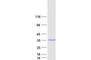 Validation with Western Blot
