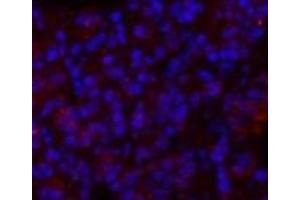 Immunofluorescence analysis of Rat lung tissue using GLUT-1 Polyclonal Antibody at dilution of 1:200. (GLUT1 anticorps)