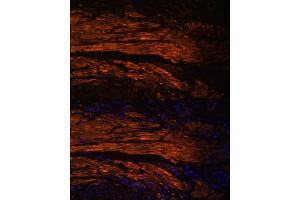 Immunofluorescence analysis of Human colon carcinoma using MYL9 antibody (ABIN3023462, ABIN3023463, ABIN3023464 and ABIN6220005) at dilution of 1:100.