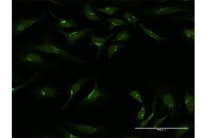 Immunofluorescence of purified MaxPab antibody to GOLGA1 on HeLa cell. (GOLGA1 anticorps  (AA 1-767))