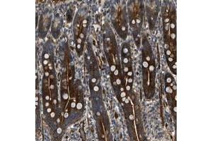Immunohistochemical staining of human duodenum with KIAA1305 polyclonal antibody  shows strong cytoplasmic and membranous positivity in glandular cells at 1:50-1:200 dilution. (NYNRIN anticorps)