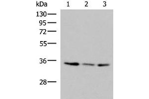 Western blot analysis of HepG2 HL60 cell Human fetal liver tissue lysates using ISY1-RAB43 Polyclonal Antibody at dilution of 1:1000 (ISY1-RAB43 Readthrough (ISY1-RAB43) anticorps)