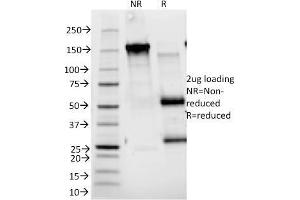 SDS-PAGE Analysis Purified CD25 Mouse Monoclonal Antibody (143-13). (CD25 anticorps)